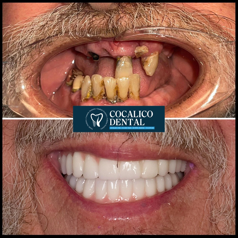 Life Changing results gallery