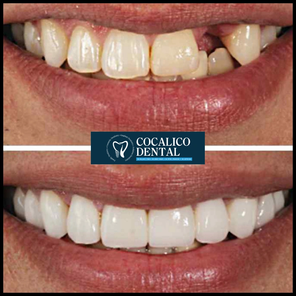 Life Changing results gallery