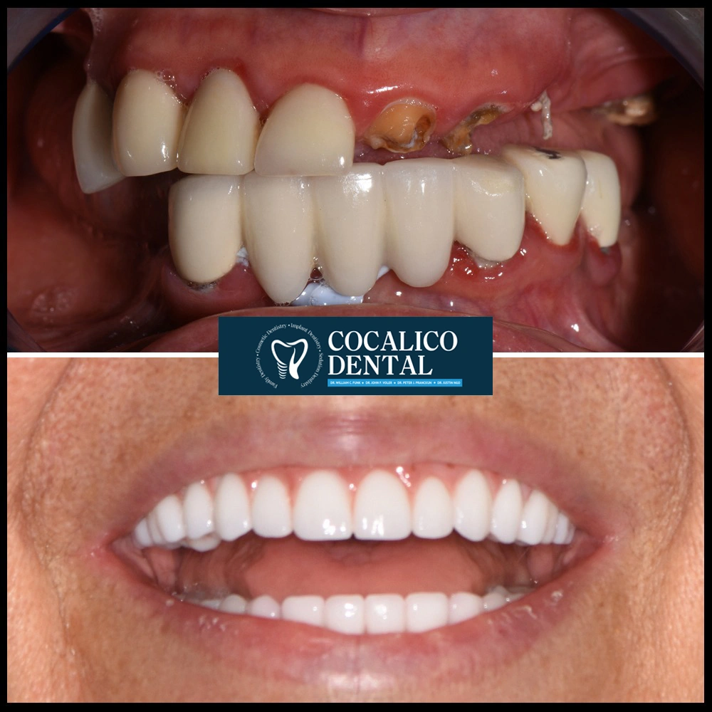Life Changing results gallery
