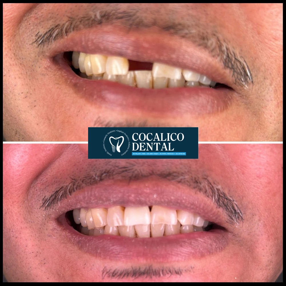 Life Changing results gallery